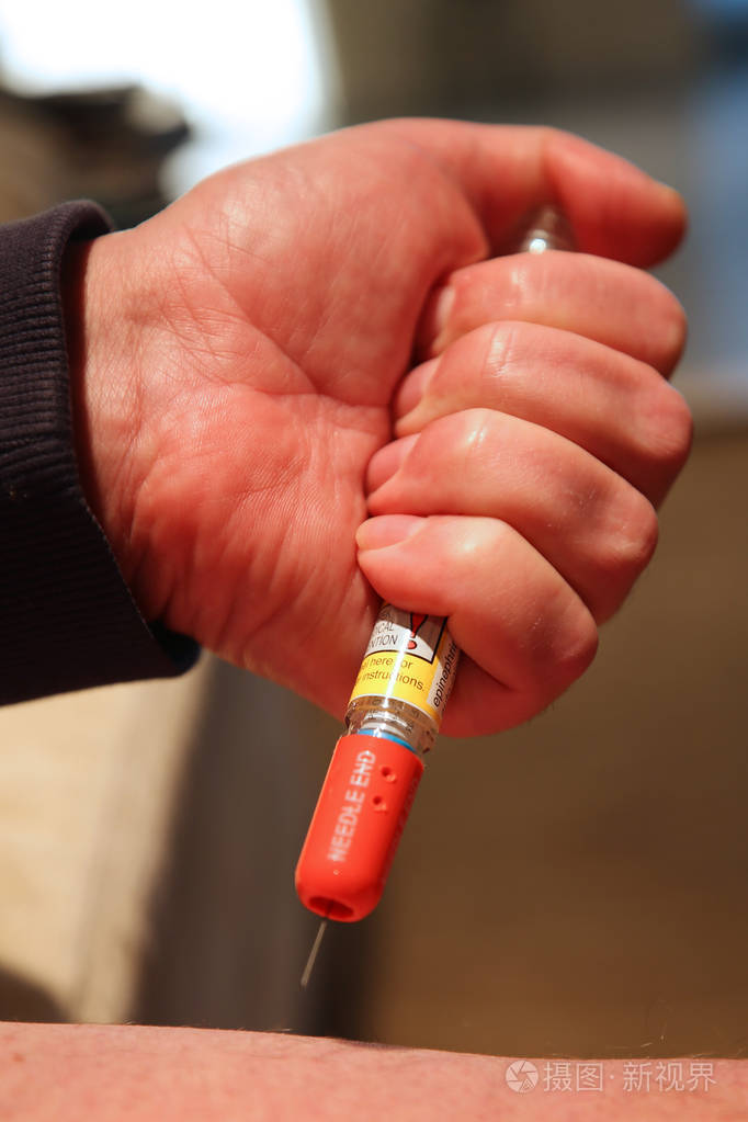 肾上腺素自动注射器是一种医疗器械,通过针头向过敏患者注射肾上腺素