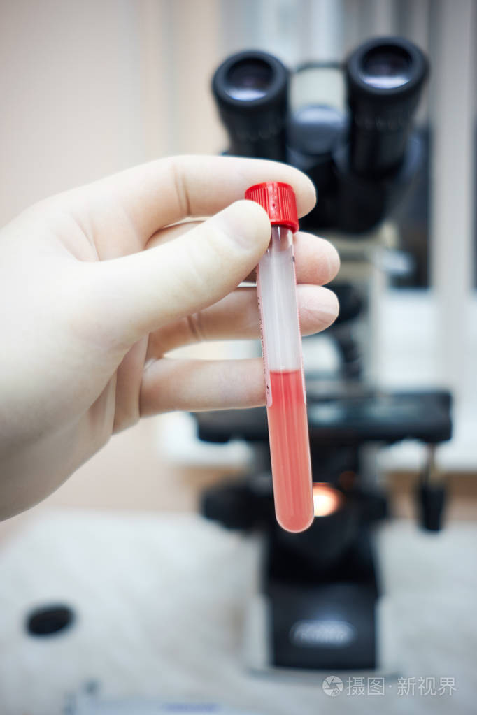 用充满血液显微镜的试管进行hadn诊断rh交叉试验