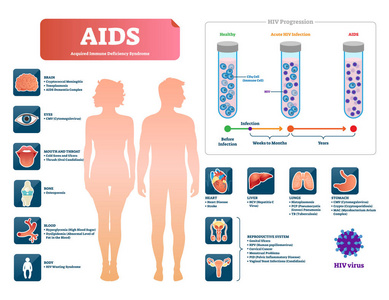 帮助或 hiv 向量例证。带有病毒症状的标记医学图