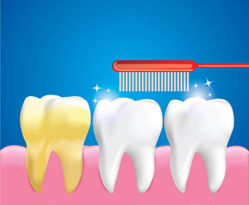 刷牙清洁牙齿护理理念逼真设计插图矢量。