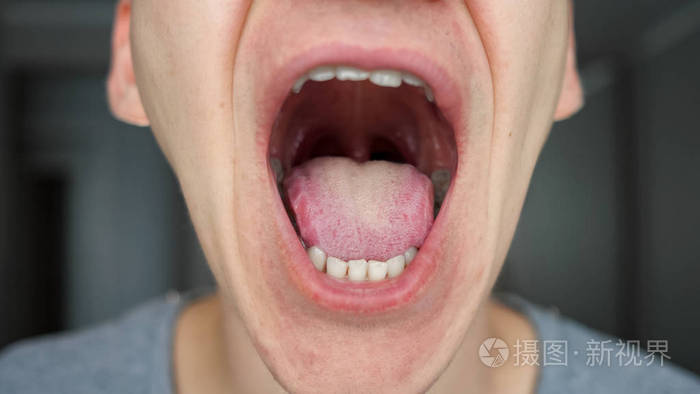男性口腔和牙齿的关闭