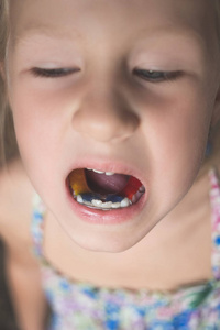 一个牙齿歪的小女孩嘴里有矫正器