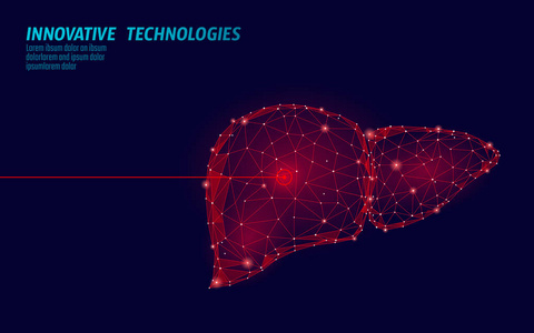 人肝激光手术低聚。药物疾病治疗疼痛部位。红色三角形多边形3d 渲染形状。药学肝炎癌症模板载体例证