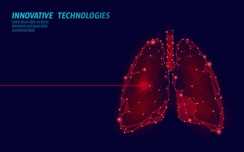 人肺激光手术低聚。药物疾病治疗疼痛部位。红色三角形多边形3d 渲染形状。药房结核癌症模板向量例证