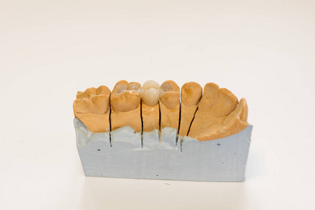 牙科石膏模型在牙科实验室办公室关闭。 石膏假牙与瓷牙隔离在白色背景复制空间