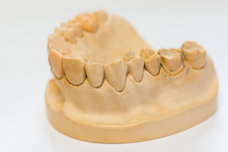 石膏假牙与瓷牙隔离在白色背景复制空间照片