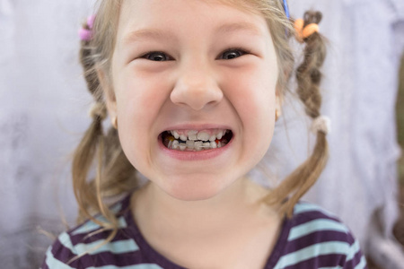 s baby teeth shark teeth. Little girlx27