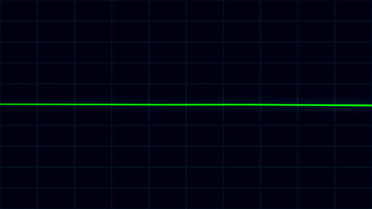 绿心跳脉冲平线心电图屏幕ekg心脏保健概念照片