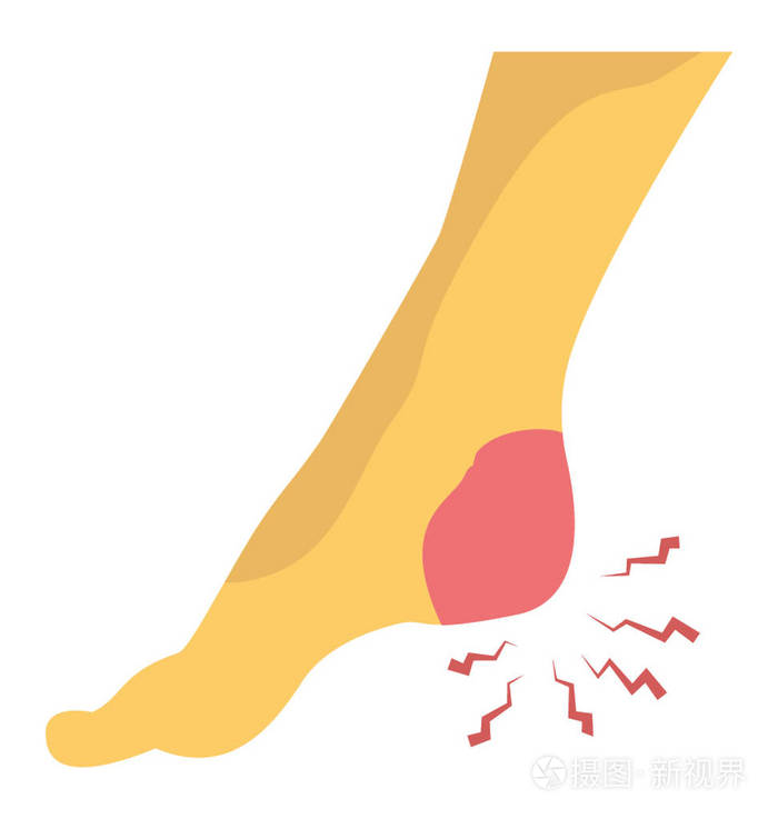 脚跟疼痛平面图标设计