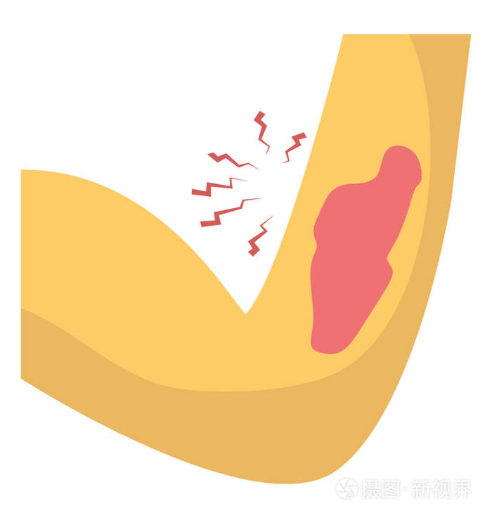 手臂侧出血概念的平面图标设计