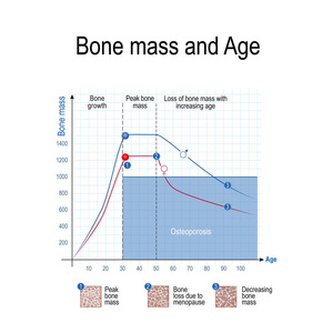 男性和女性的骨量。 年龄和骨质疏松症。 图表。 健康的生活方式。 教育科学和医学用途矢量图