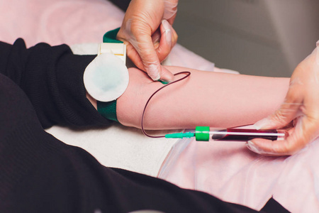 设备上的人血液透析医生采集血液的注射器,护士要采取从静脉血在胳膊