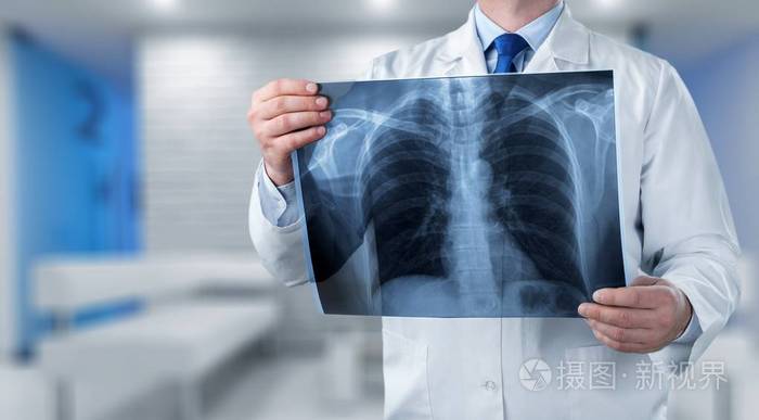 一位年轻医生的画像,他拿着人胸x光
