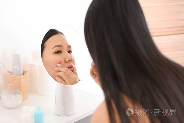 有痤疮问题的年轻亚洲女人照镜子的画像
