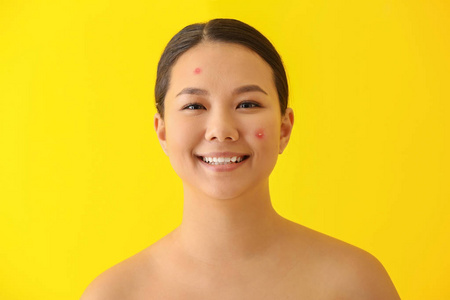 亚洲年轻女性的肖像，有痤疮问题的颜色背景