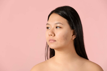 亚洲年轻女性的肖像，有痤疮问题的颜色背景