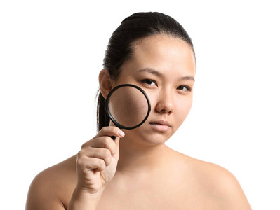 放大问题年轻亚洲女性痤疮问题肖像和白色背景放大镜照片