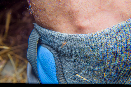 蚊子步行。 蚊子在腿上。 小吸血蚊子。 男人腿上的昆虫。 常见的蚊子或蚊子。 毛茸茸的腿。 两只有翅膀的昆虫以血液为食。