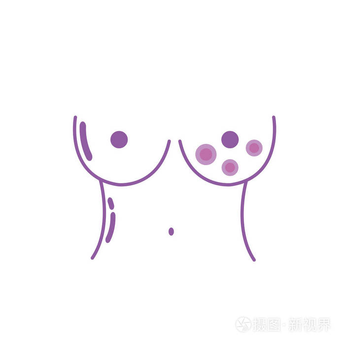 乳腺癌疾病剪影和医疗支持向量插图插画-正版商用图片17m7d9-摄图新