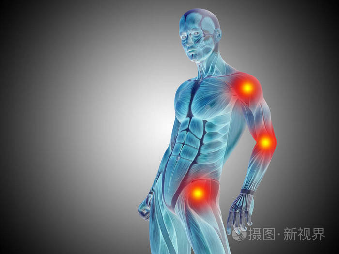 概念三维图示人体解剖上体或健康设计关节或关节疼痛或损伤的灰色梯度