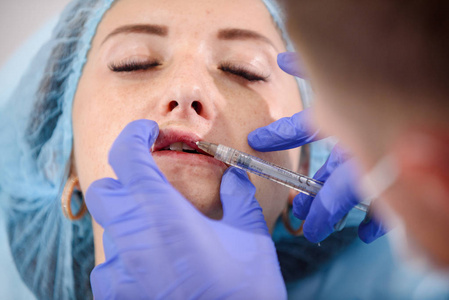  doctor does lip augmentation surgery