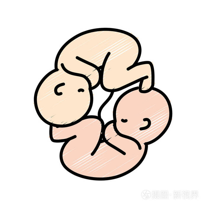 可爱的婴儿双胞胎脐带矢量插图