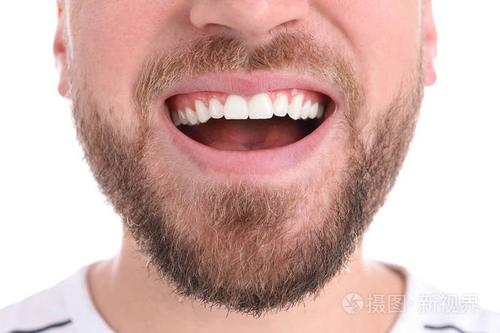 在白色背景特写镜头上露出健康牙齿的年轻人