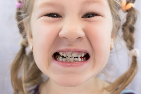 s baby teeth shark teeth. Little girl39