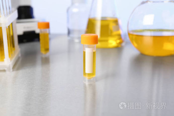 有尿液样本的容器供化验内的桌子分析