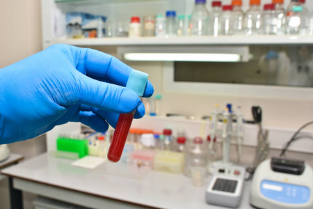 实验室的血液测试。 带有生物样品的试管将手放在乳胶手套中。