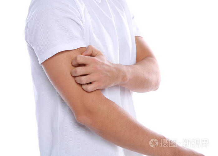 年轻人在白色背景上抓手臂,特写.烦人的痒