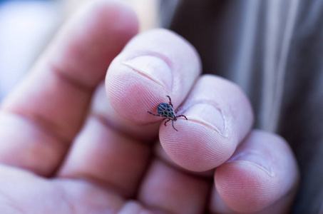 s arm. Mite on the fingers.