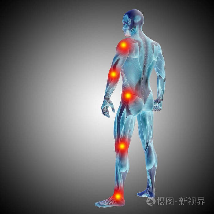 人体解剖体疼痛和炎症的概念三维插图灰色梯度背景