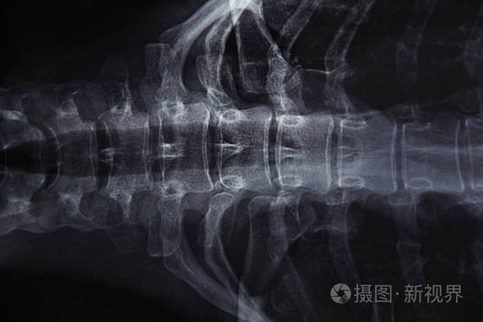 一个年轻女人的x射线