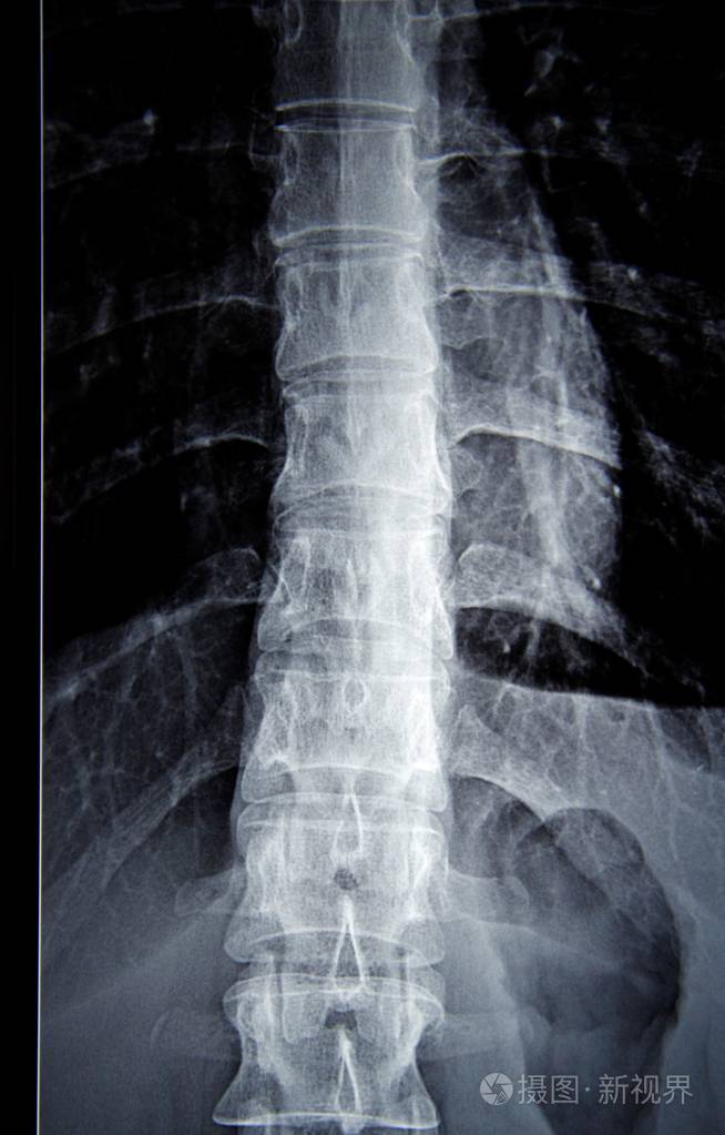 一个年轻女人的x光照片-正版商用图片188x9z-摄图新视界
