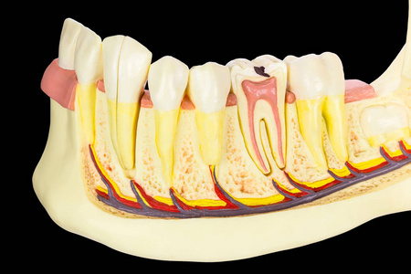 黑色背景下牙齿分离的人颌骨模型照片