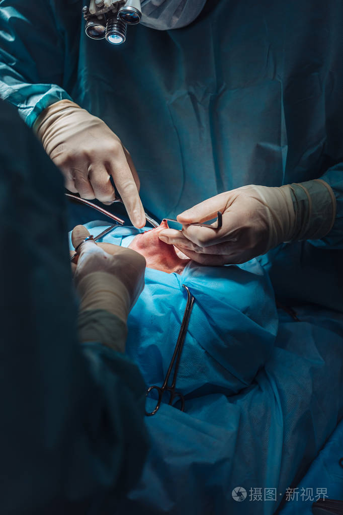 鼻子上的整容手术.外科医生割肉