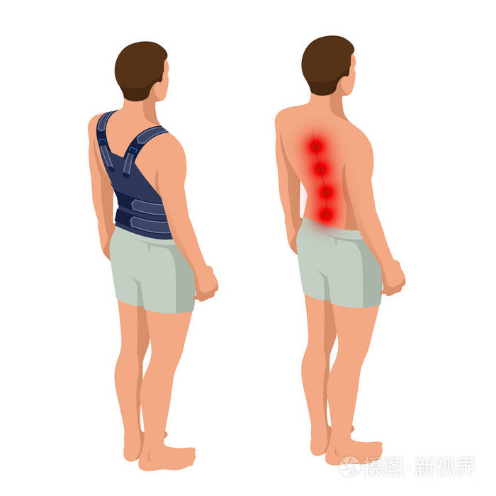 下背部疼痛或脊柱疼痛骨质疏松症一个男人的解剖身体创伤后的康复骨科
