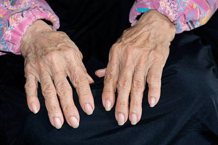 一位老年妇女的手的细节