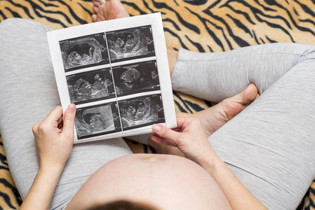 孕妇持有超声波的图像。 孕妇看着她的婴儿超声波检查。 幸福的孕妇享受她未出生的孩子的第一张照片，期待她的未来生活