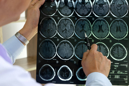 脑科专业的脑科医生给病人提供顾问,并告诉病人详细情况,以帮助病人