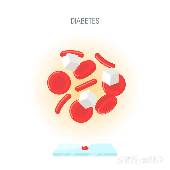 扁平化的糖尿病概念, 矢量设计插画-正版商用图片18pjhc-摄图新视界