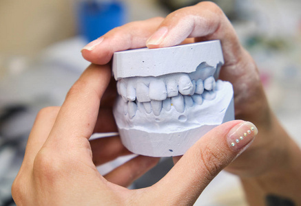 牙医手中拿着一张印有3D的义齿下巴。 病人在牙科诊所看未来贴面的形状