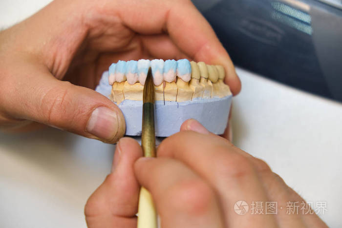 牙医手中拿着一张印有3d的义齿下巴 病人在牙科诊所看未来贴面的形状照片 正版商用图片18w4tk 摄图新视界