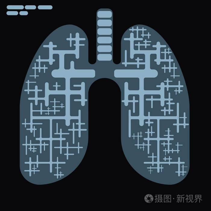 黑色平面画的x射线插图