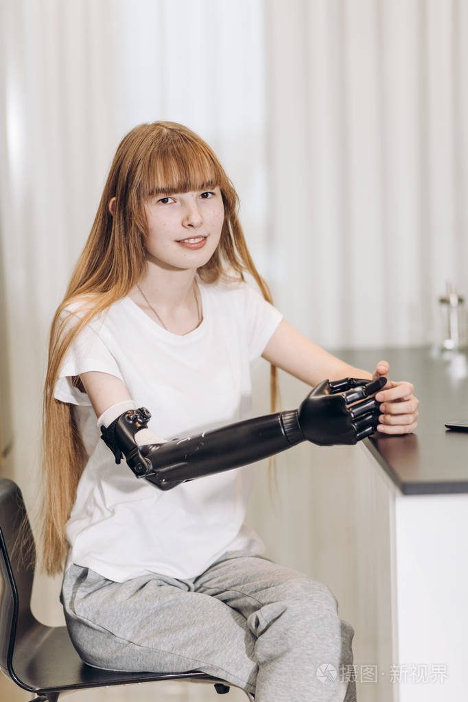 平静残疾女孩在休闲服与人工设备而不是真正的手臂