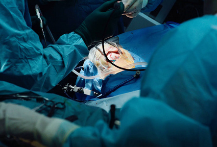 神经外科医生进行手术切除脑瘤