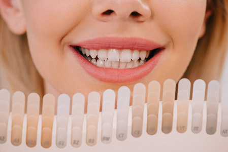 微笑的女人抱着牙齿，调色板，牙齿美白的概念