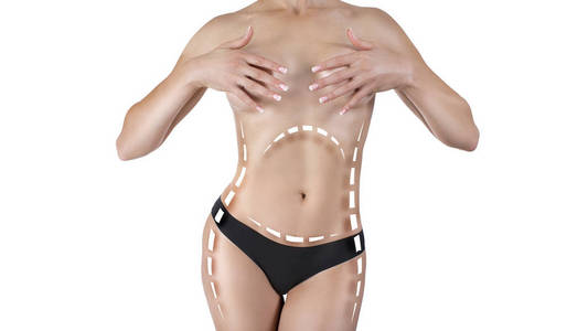 腹部有痕迹的女性身体。瘦身整形外科和节食的概念