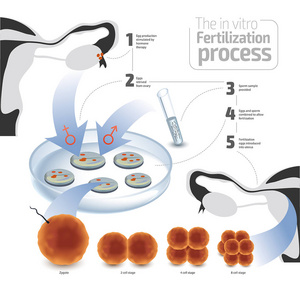 体外受精的矢量图解概念。五颜六色在白色背景